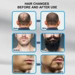 140 Titanium Adjustable Micro needling