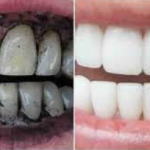 AMK2 Herbal Umikari Rice Husk Tooth Powder with Salt, 100% Natural, Chemical-Free, no color added